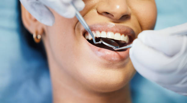 Best Urgent Care for Lost Fillings or Crowns in Pickerington, OH