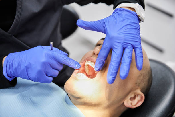 Best Emergency Wisdom Teeth Removal in Pickerington, OH
