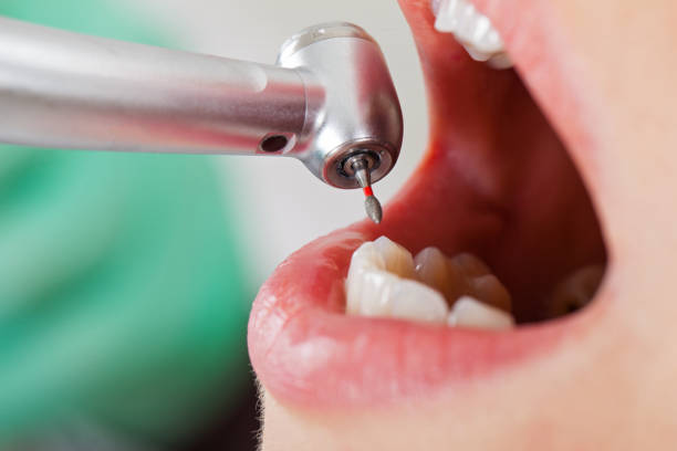 Best Pediatric Emergency Dentist in Pickerington, OH